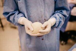 Professionnelle de santé préparant la pose d'un implant contraceptif sur un bras féminin