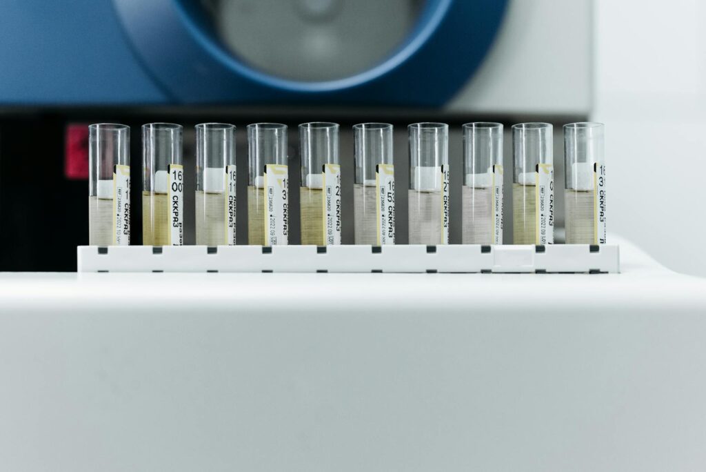 Flacon de prélèvement salivaire posé sur table médicale blanche